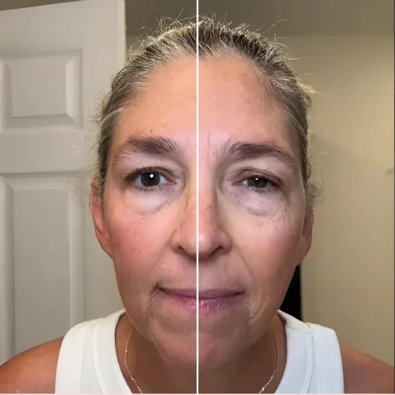 Sovita I Brosse sculptante drainage lymphatique